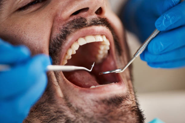 Best Broken or Chipped Tooth Repair in Jonestown, PA
